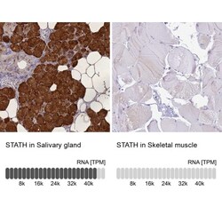 STATH Antibody, Novus Biologicals 25 &mu;L, Unlabeled:Antibodies, Polyclonal
